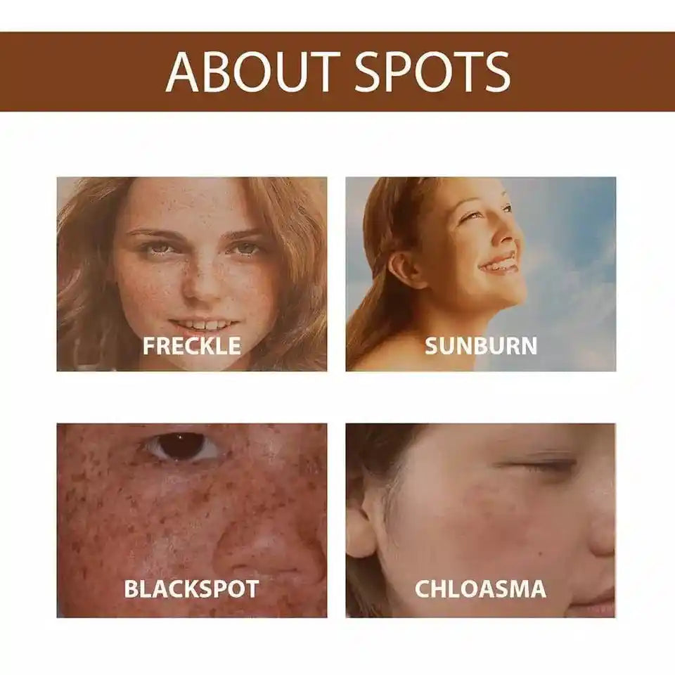 Anti-Freckle Serum