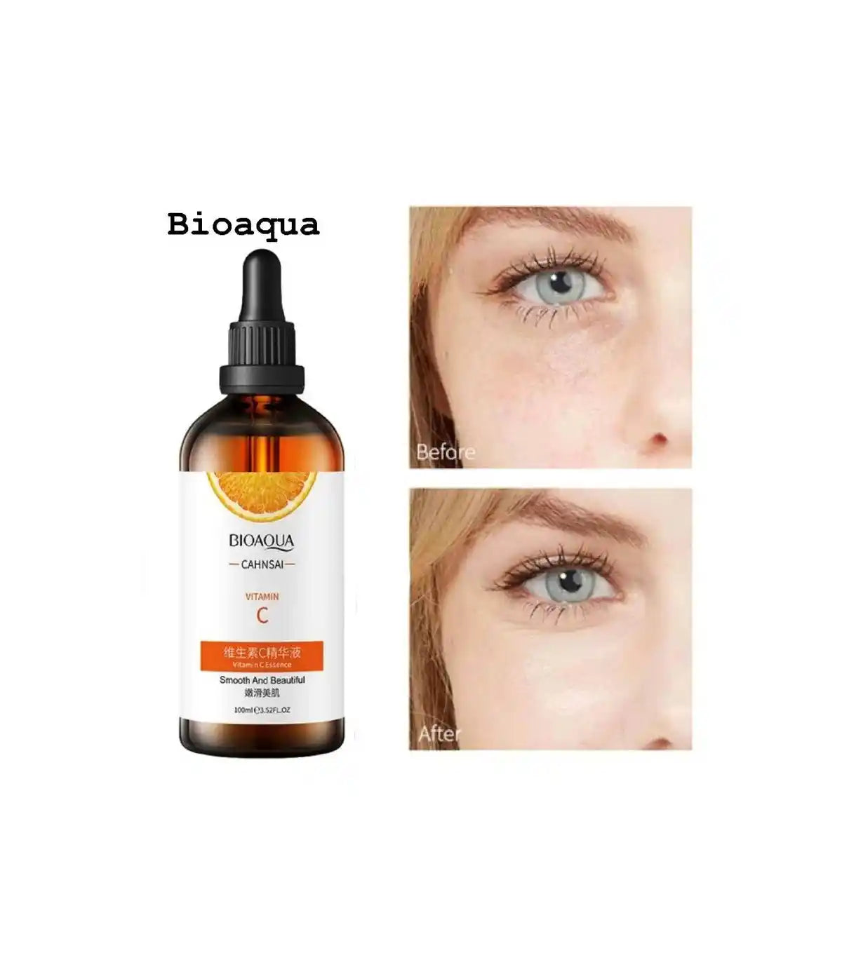 Vitamin C Serum – 100ml | Brightening & Anti-Aging Formula